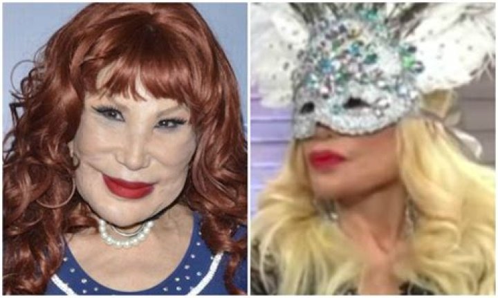 Lyn May y su rostro antes de las cirugías El Diario NY